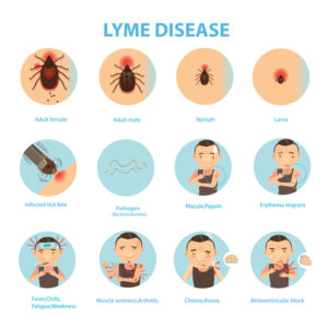 Lyme disease stages 